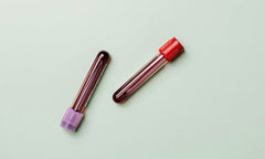 妊活でホルモン検査はなぜするの?検査の概要やホルモン検査で分かること